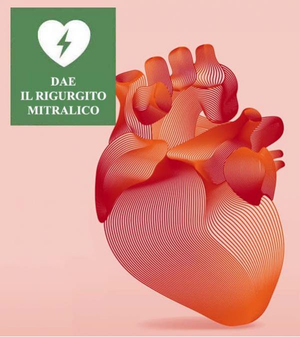 IL RIGURGITO MITRALICO